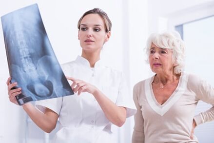 L'examen aux rayons X est un moyen informatif de diagnostiquer l'ostéochondrose de la colonne vertébrale