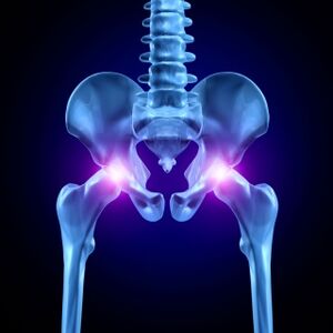La douleur dans les articulations de la hanche peut être aiguë, douloureuse ou chronique