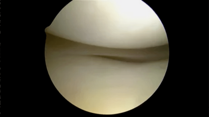 vue astroscope de surfaces complètement saines